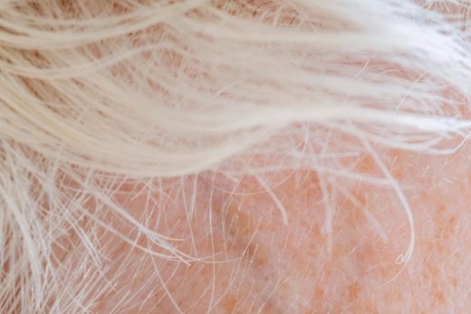 Le PRP : une technique de régénération cellulaire pour le cuir chevelu ou la peau
