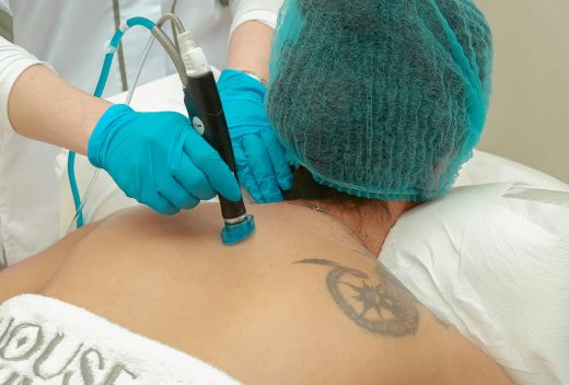 Effacer&#x20;ses&#x20;tatouages&#x20;gr&#x00E2;ce&#x20;au&#x20;laser&#x20;Deletis&#x20;au&#x20;centre&#x20;L&#x2019;Espace&#x20;M&amp;&#x23;038&#x3B;V&#x20;&#x00E0;&#x20;La&#x20;Seyne-sur-Mer