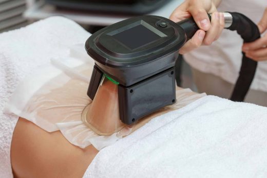 Cryolipolyse à toulon: la solution pour éliminer la graisse localisée sans chirurgie